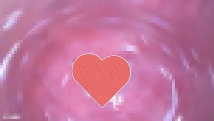 FC2-PPV-4502178 Yu (19) A video taken out of the warehouse during the first shooting. - A test tube or Cuzco was inserted into the vagina and an endoscopy was taken. - Blame the guy who sucks with his mouth wide open